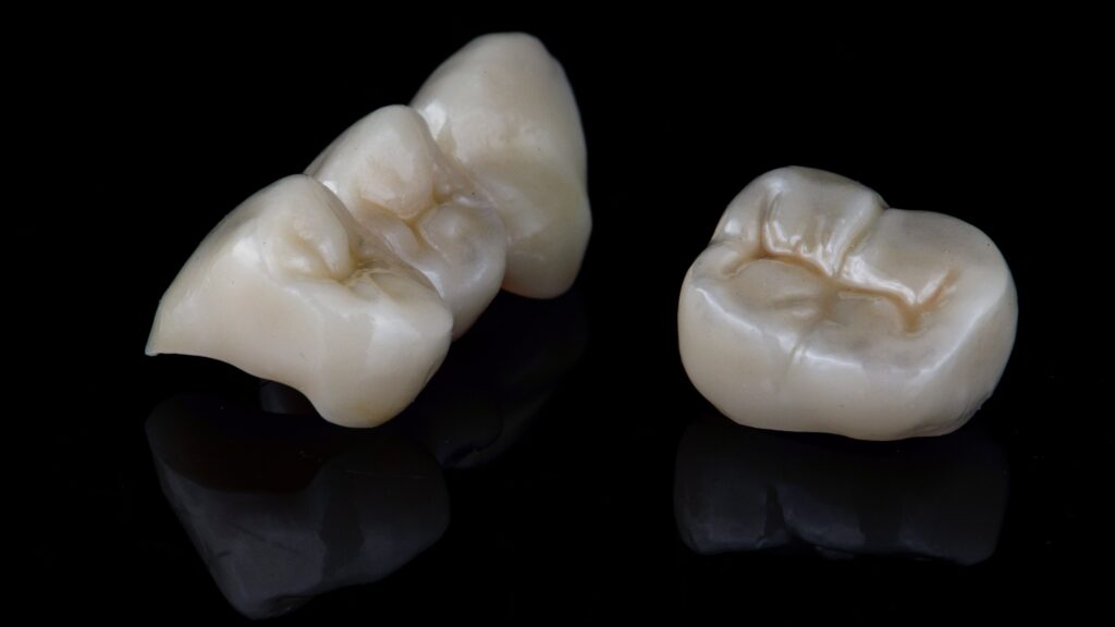 Dental Crowns