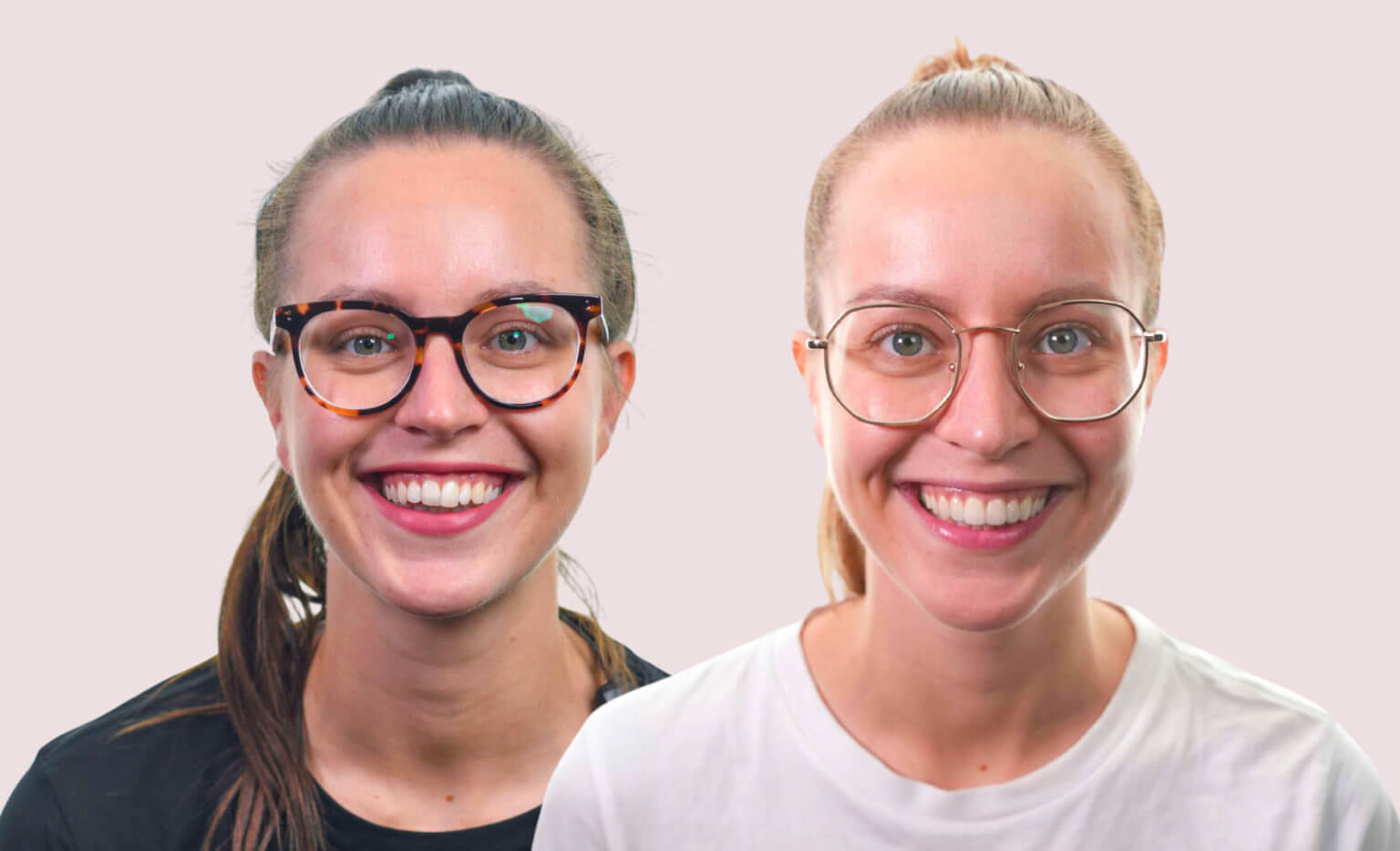 Caring for your veneers 