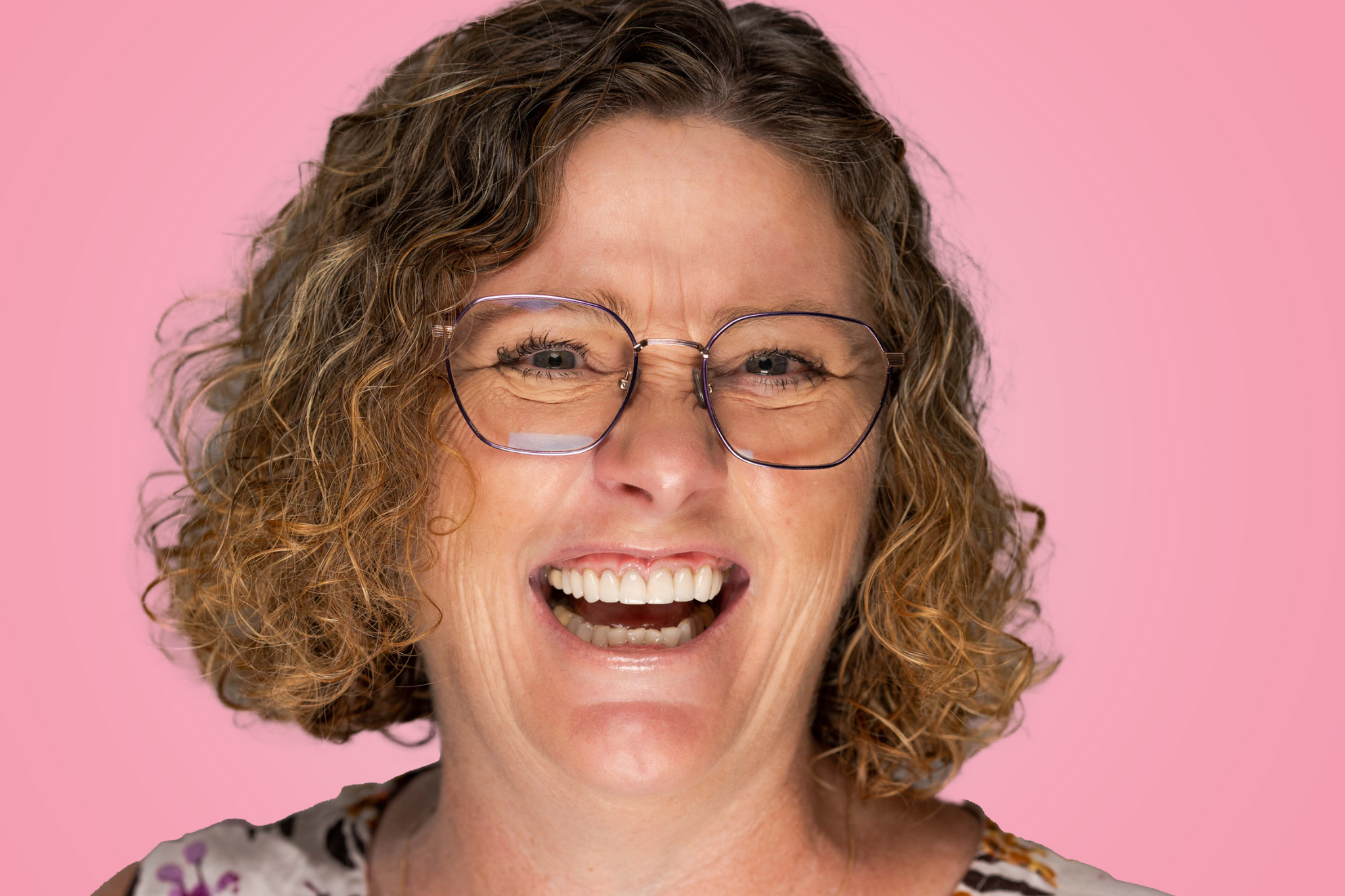 Composite vs Porcelain Veneers