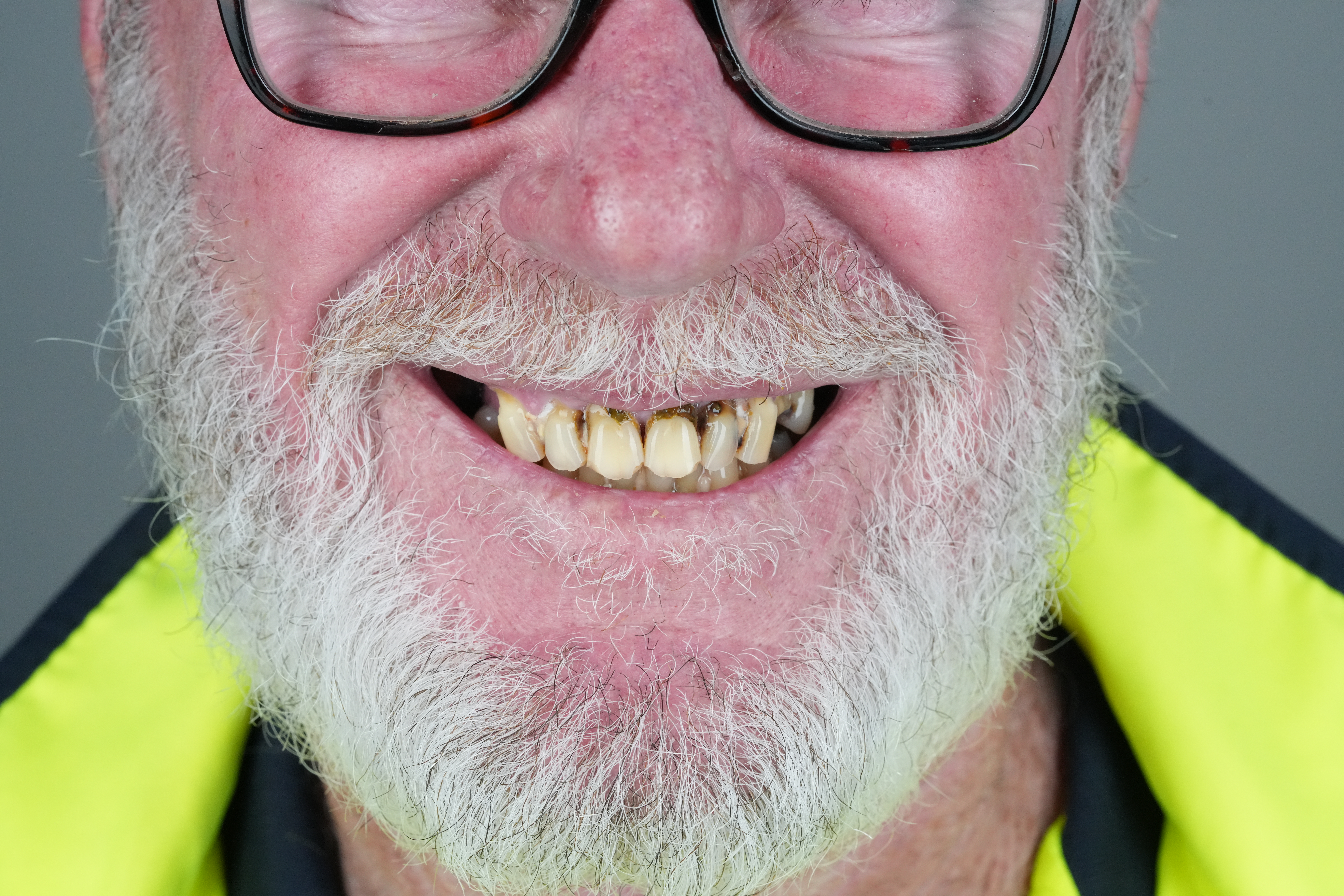 The consequences of neglecting oral health 