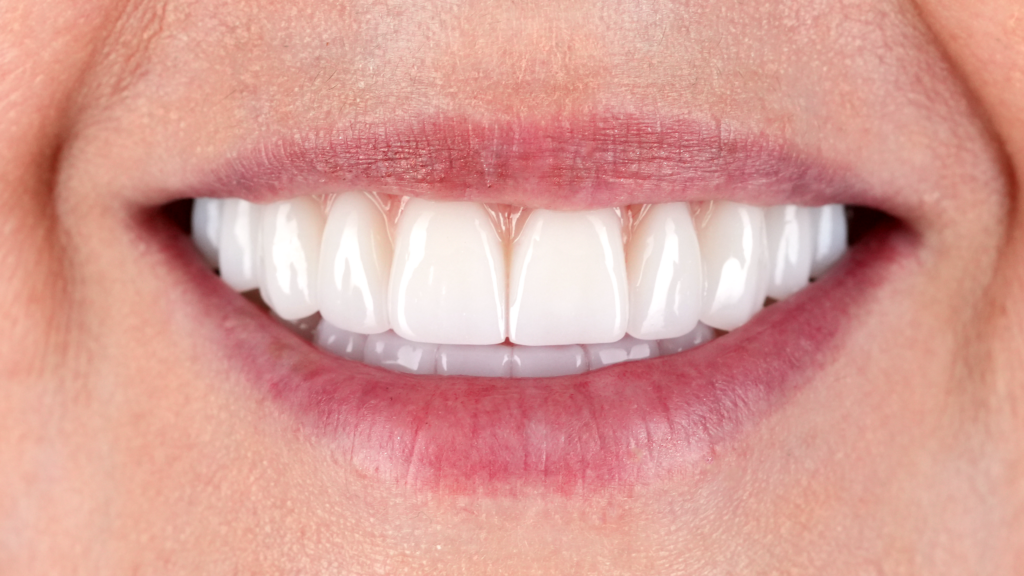 Long-term implications of untreated tooth decay