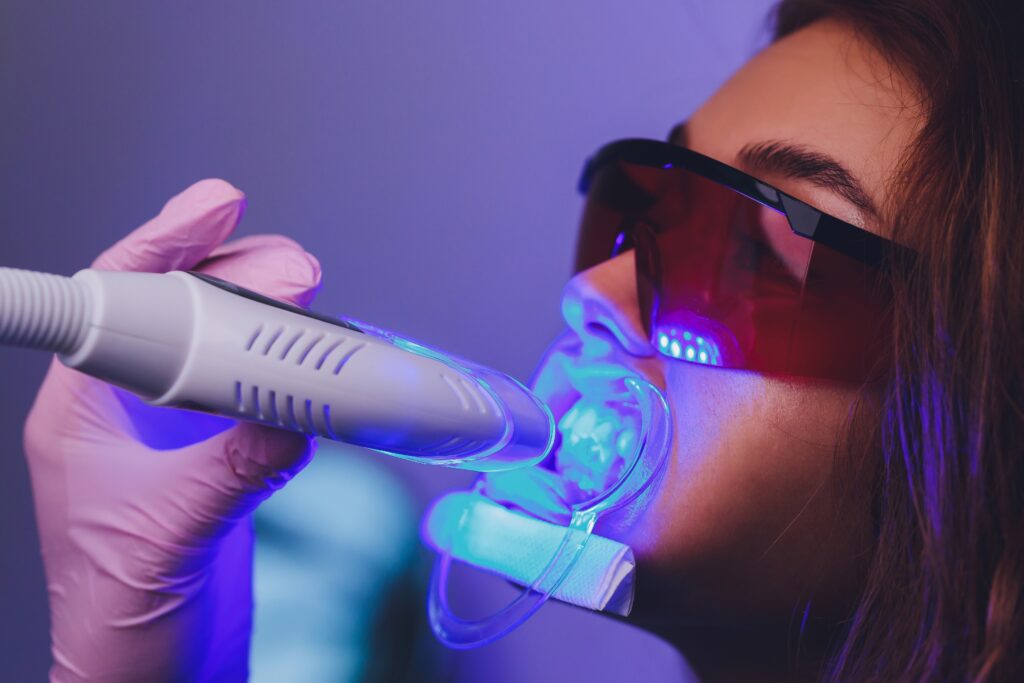 Teeth whitening treatments