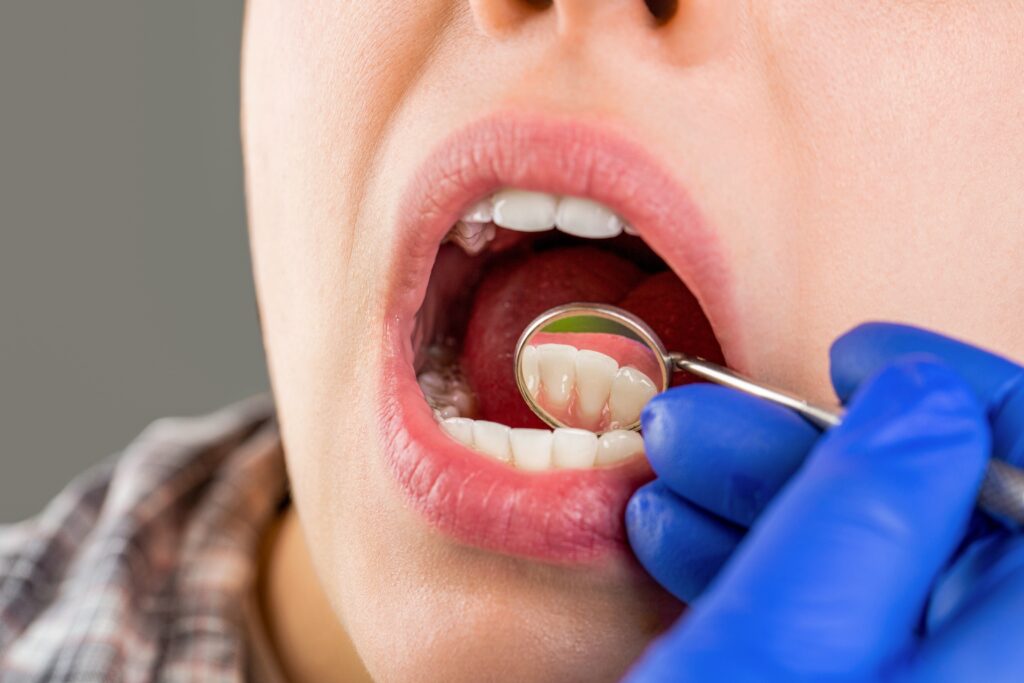 Potential Dental Implant Issues