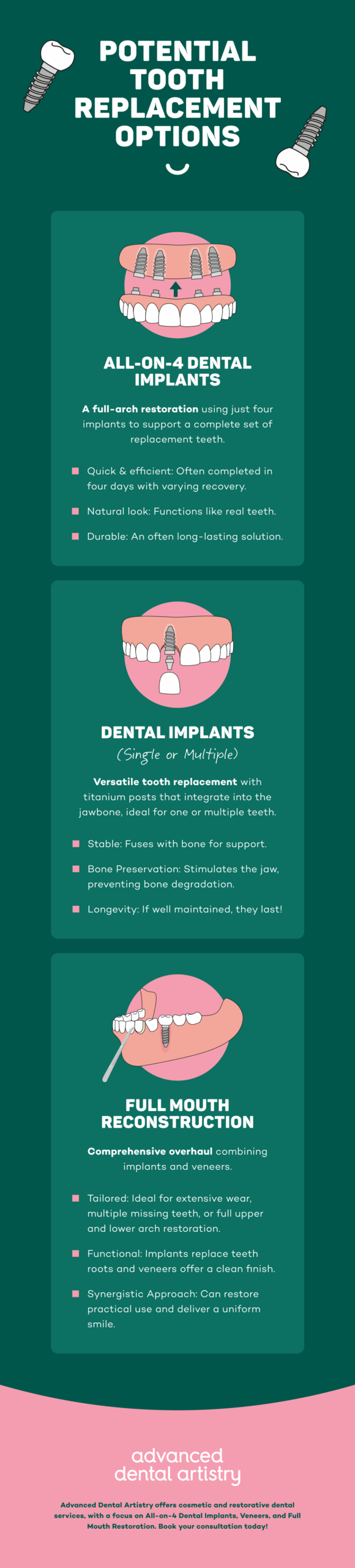Tooth Replacement Options Infographic